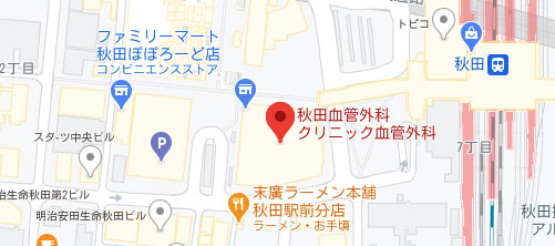 秋田血管外科クリニック地図
