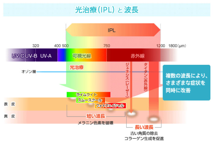 光治療と波長