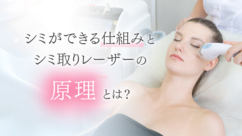 シミができる仕組みとシミ取りレーザーの原理とは？