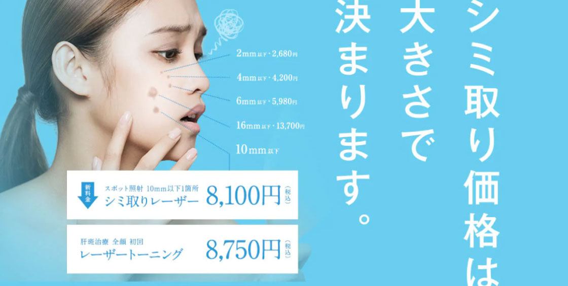 湘南美容クリニックのシミ取りレーザー