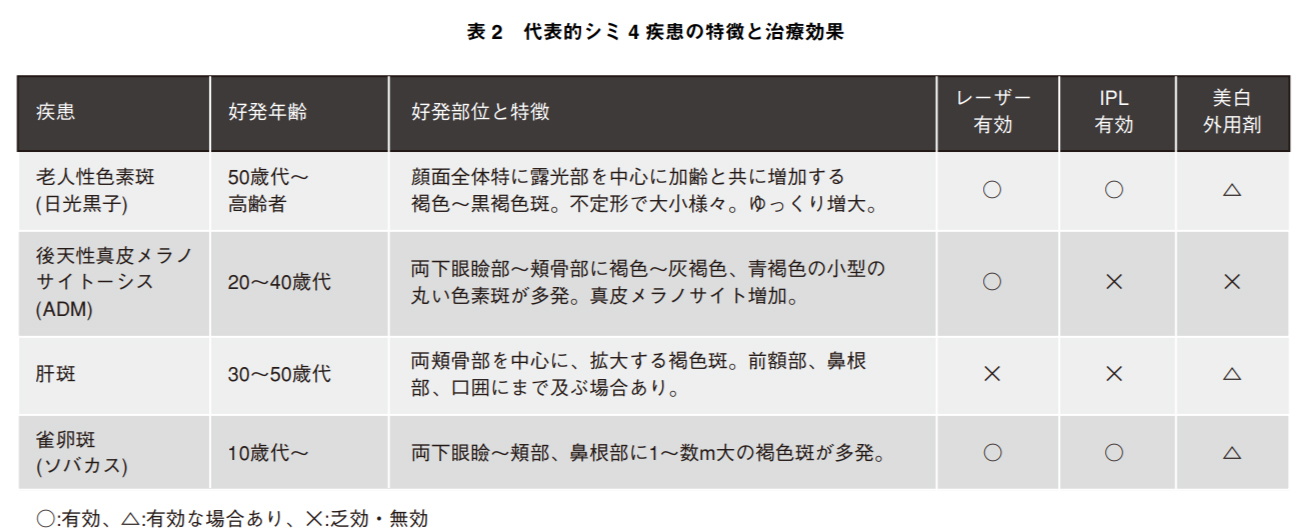 代表的シミ4疾患の特徴と治療効果